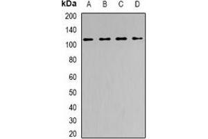 Western blot analysis of SNF2H expression in PC3 (A), HepG2 (B), mouse spleen (C), mouse brain (D) whole cell lysates. (SMARCA5 antibody)