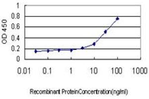 Detection limit for recombinant GST tagged ME1 is approximately 1ng/ml as a capture antibody. (ME1 antibody  (AA 1-572))