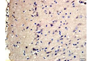 Formalin-fixed and paraffin embedded rat brain labeled with Rabbit Anti-TSC2(Ser1798) Polyclonal Antibody, Unconjugated (ABIN712121) at 1:200 followed by conjugation to the secondary antibody and DAB staining