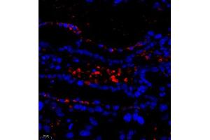 Immunofluorescence of paraffin embedded mouse placenta using DEPDC1 (ABIN7073717) at dilution of 1:500 (400x lens) (DEPDC1 antibody)