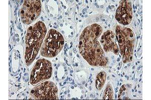 Immunohistochemical staining of paraffin-embedded Human Kidney tissue using anti-ACY1 mouse monoclonal antibody. (Aminoacylase 1 antibody)