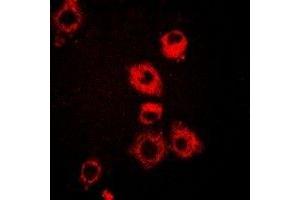 Immunofluorescent analysis of VAP-1 staining in A549 cells. (AOC3 antibody)