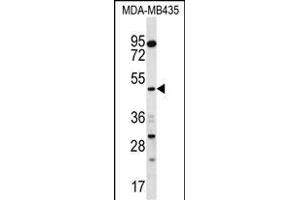 SNX4 Antibody (C-term) (ABIN656781 and ABIN2845999) western blot analysis in MDA-M cell line lysates (35 μg/lane).