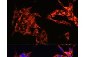 Immunofluorescence analysis of HeLa cells using PIK3CA Polyclonal Antibody at dilution of 1:100. (PIK3CA antibody)