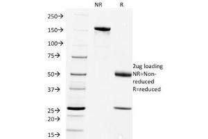 SDS-PAGE Analysis of Purified, BSA-Free Rabies Virus Antibody (clone Rab-50). (Rabies Virus antibody)