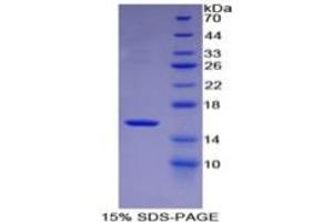 SDS-PAGE of Protein Standard from the Kit  (Highly purified E. (MBL2 ELISA Kit)