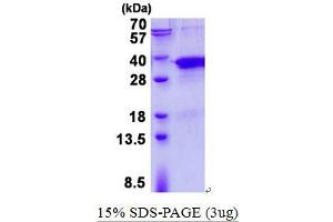 Image no. 1 for Translin-Associated Factor X (TSNAX) protein (His tag) (ABIN1098463) (TSNAX Protein (His tag))
