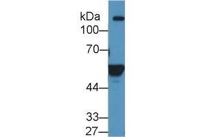 Western Blotting (WB) image for anti-Aldehyde Dehydrogenase 1 Family, Member A2 (ALDH1A2) (AA 1-422) antibody (ABIN7435901)