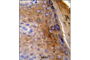 Formalin-fixed and paraffin-embedded human skin reacted with KRT10 Antibody , which was peroxidase-conjugated to the secondary antibody, followed by DAB staining. (Keratin 10 antibody  (AA 318-346))