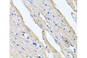 Immunohistochemistry (Paraffin-embedded Sections) (IHC (p)) image for anti-Reticulocalbin 2, EF-Hand Calcium Binding Domain (RCN2) antibody (ABIN7011940)