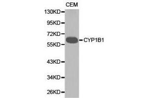 Western Blotting (WB) image for anti-Cytochrome P450, Family 1, Subfamily B, Polypeptide 1 (CYP1B1) antibody (ABIN1872164) (CYP1B1 antibody)