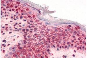 Human Skin (formalin-fixed, paraffin-embedded) stained with GLI2 antibody ABIN351530 at 5 ug/ml followed by biotinylated goat anti-rabbit IgG secondary antibody ABIN481713, alkaline phosphatase-streptavidin and chromogen. (GLI2 antibody  (AA 46-60))