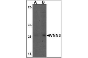 Western blot analysis of VNN3 in human brain tissue lysate with VNN3 Antibody  at (A) 0. (VNN3 antibody  (C-Term))