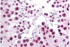 Human Testis: Formalin-Fixed, Paraffin-Embedded (FFPE) (SIRT1 antibody  (AA 456-555))