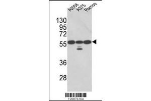 Western blot analysis of PDIA3 Antibody in A2058, A375, Ramos cell line lysates (35ug/lane)(2ug/ml) (PDIA3 antibody  (AA 192-220))