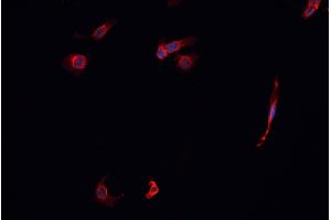 ABIN6268814 staining K-562 cells by IF/ICC. (KEAP1 antibody)