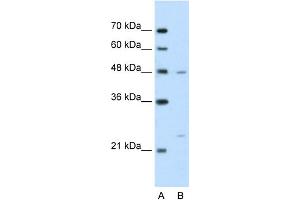 WB Suggested Anti-BSDC1 Antibody Titration:  2. (BSDC1 antibody  (N-Term))