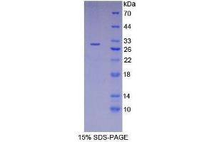 SDS-PAGE (SDS) image for Receptor-Interacting serine-threonine Kinase 3 (RIPK3) (AA 16-239) protein (His tag) (ABIN1879214)