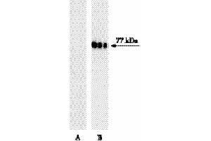 Western blot analysis of Btk (pY551) in human Burkitt’s lymphoma. (Btk and Itk (pTyr551) antibody)