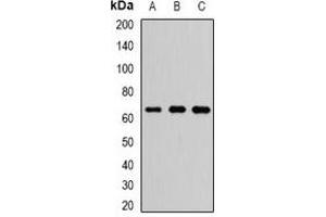 Western blot analysis of FXR1 expression in HepG2 (A), Hela (B), SW480 (C) whole cell lysates. (FXR1 antibody)