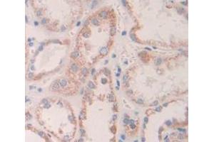 IHC-P analysis of Human Tissue, with DAB staining. (Angiopoietin 1 antibody  (AA 21-228))