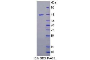 SDS-PAGE analysis of Mouse UQCRB Protein. (UQCRB Protein)