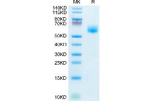 Human IL-1RL1 on Tris-Bis PAGE under reduced condition. (IL1RL1 Protein (AA 19-328) (His tag))