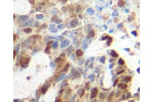 Image no. 2 for anti-Tumor Necrosis Factor alpha (TNF alpha) antibody (ABIN465605) (TNF alpha antibody)