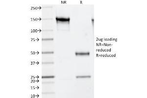 SDS-PAGE Analysis Purified Thymidylate Synthase Mouse Monoclonal Antibody (TS106). (TYMS antibody)