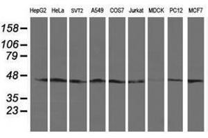 Image no. 2 for anti-serpin Peptidase Inhibitor, Clade B (Ovalbumin), Member 13 (SERPINB13) antibody (ABIN1500878) (SERPINB13 antibody)