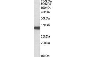 Western Blotting (WB) image for anti-Aspartoacylase (ASPA) (AA 301-312) antibody (ABIN793280)