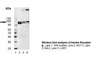 Image no. 1 for anti-Insulin Receptor (INSR) (Cytoplasmic Domain) antibody (ABIN331470) (Insulin Receptor antibody  (Cytoplasmic Domain))