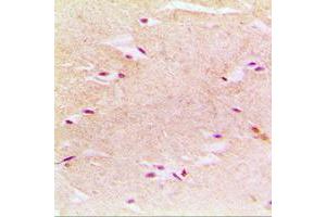 Immunohistochemical analysis of PEX14 staining in human muscle formalin fixed paraffin embedded tissue section. (PEX14 antibody  (Center))