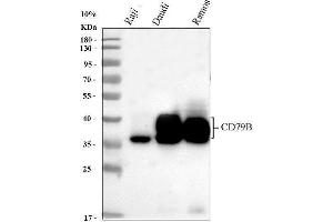Western blot analysis of CD79b using anti-CD79b antibody (ABIN3043398).