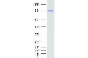 Validation with Western Blot