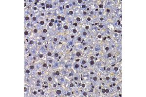 Immunohistochemistry of paraffin-embedded mouse liver using FIP1L1 antibody at dilution of 1:100 (x400 lens).