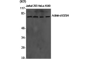 Western Blotting (WB) image for anti-Actinin, alpha 1/2/3/4 (ACTN1/ACTN2/ACTN3/ACTN4) antibody (ABIN5960682) (ACTN1/2/3/4 antibody)