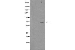 Western blot analysis of Hela whole cell lysates, using RBBP4 Antibody. (Retinoblastoma Binding Protein 4 antibody  (C-Term))