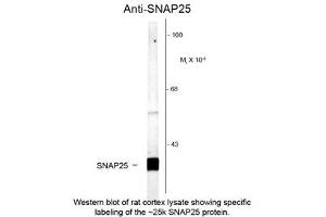 Image no. 1 for anti-Synaptosomal-Associated Protein, 25kDa (SNAP25) antibody (ABIN956767) (SNAP25 antibody)