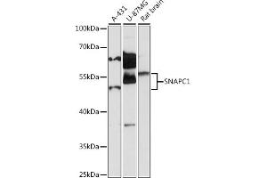 Western blot analysis of extracts of various cell lines, using SN antibody (ABIN7270367) at 1:1000 dilution.