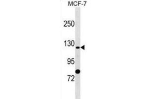 Western Blotting (WB) image for anti-Solute Carrier Family 4, Sodium Bicarbonate Cotransporter, Member 9 (SLC4A9) antibody (ABIN2999782) (SLC4A9 antibody)