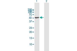 Western Blot analysis of GALNS expression in transfected 293T cell line by GALNS MaxPab polyclonal antibody.