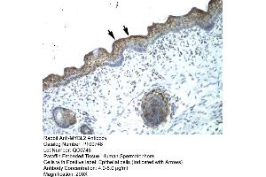 Human Spermatophore (MYBL2 antibody  (N-Term))