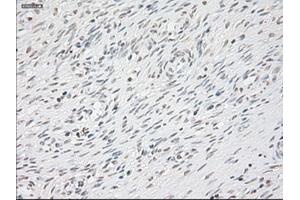 Image no. 2 for anti-Glial Fibrillary Acidic Protein (GFAP) antibody (ABIN1498441) (GFAP antibody)