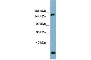 WB Suggested Anti-EPRS  Antibody Titration: 0. (EPRS antibody  (Middle Region))