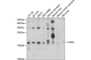 Western blot analysis of extracts of various cell lines, using  antibody (ABIN6131176, ABIN6136646, ABIN6136647 and ABIN6222857) at 1:1000 dilution. (AGR2 antibody  (AA 21-175))