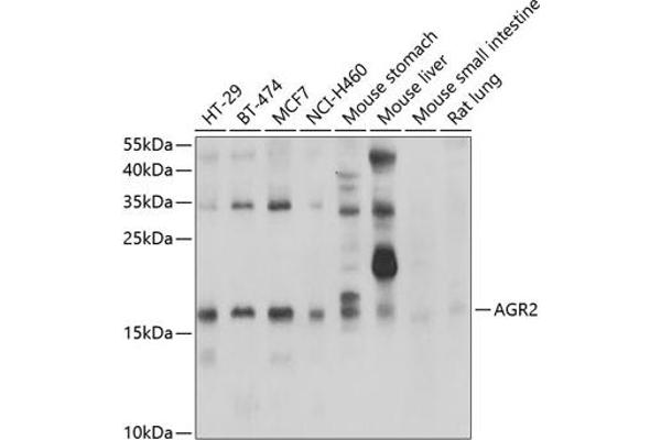 AGR2 anticorps  (AA 21-175)