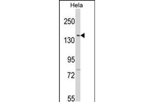 Western blot analysis of LTK2 N-term in Hela cell line lysates (35ug/lane) (LMTK2 antibody  (N-Term))