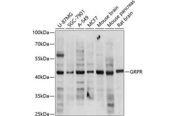 GRPR antibody  (AA 235-384)