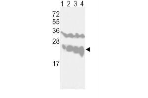 Western Blotting (WB) image for anti-Ubiquitin Carboxyl-terminal Esterase L1 (Ubiquitin Thiolesterase) (UCHL1) antibody (ABIN3001459) (UCHL1 antibody)